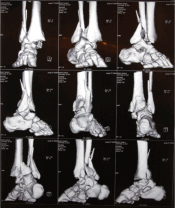 radiology billing services