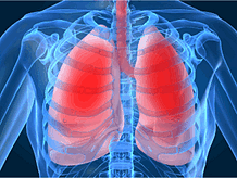 pulmonology billing services