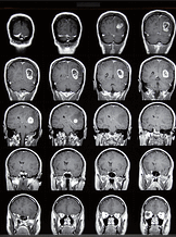 imaging billing